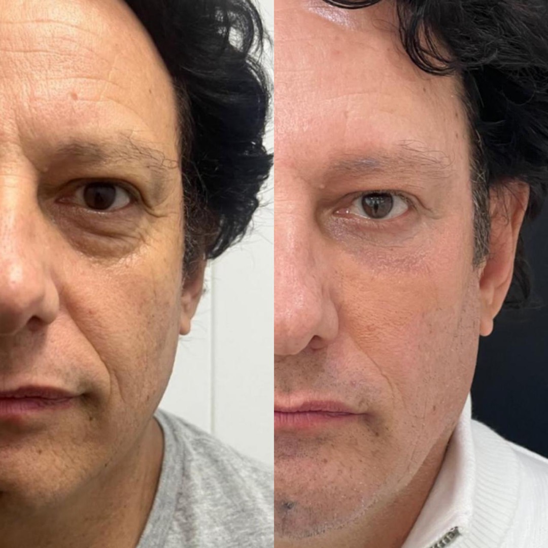 Antes e depois — Clínica Fischer