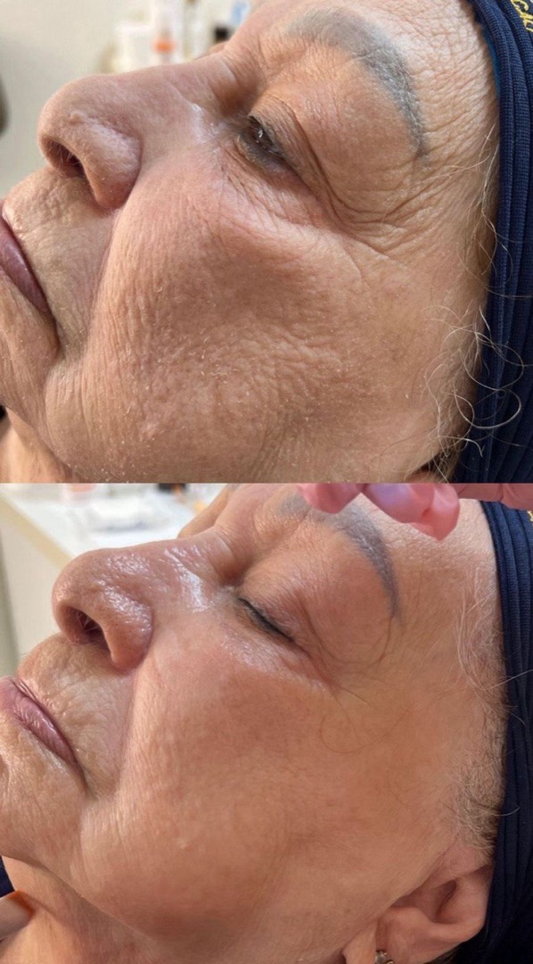 Antes e depois — Clínica Fischer