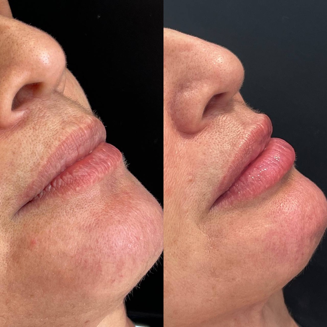 Antes e depois — Clínica Fischer